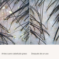 SCALP CARE EXFOLIATOR 100ML | SALON CULTURE