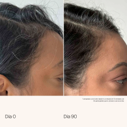 Scalp Care Density Serum | SALON CULTURE