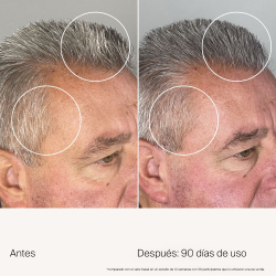 Scalp Care Density Serum | SALON CULTURE